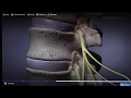Dr. Sameer Mathur discusses how to perform a Lumbar Laminectomy