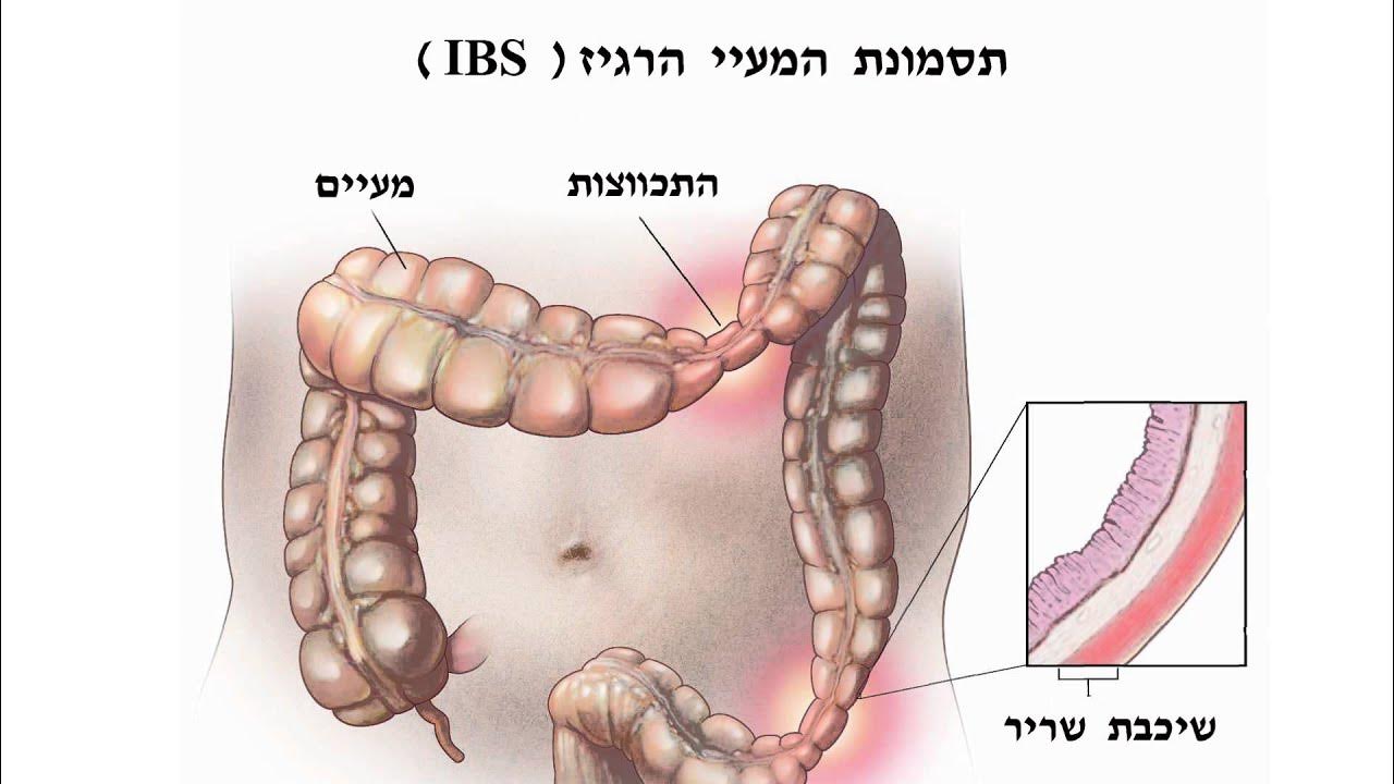 болезни кишечника список и симптомы. болезни тонкого кишечника симптомы. заболевания кишечника симптомы. заболевания тонкого кишечника симптомы. кишечные проявления болезни крона.