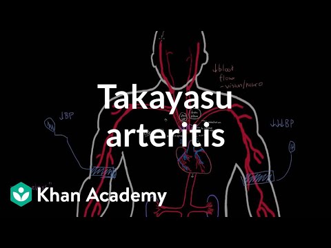 Video: Takayasuov Arteritis: Simptomi, Vrste, Zdravljenje In še Več