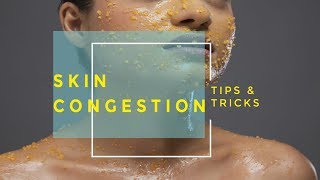 How To Treat Problem Skin - Skin Congestion