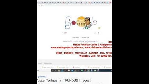 Retinal Vessel Tortuosity in FUNDUS Images - MATLAB