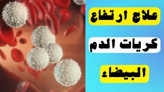 علاج ارتفاع كريات الدم البيضاء