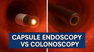 Revolution in Digestive Diagnostics: 3D Colonoscopy & Capsule Endoscopy