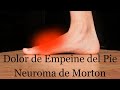 Dolor de empeine o parte superior del pie neuroma de morton