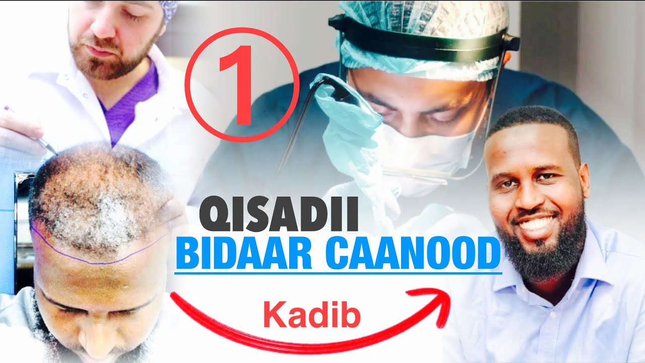 Qiso Dhab ah Part1- Halista lagala kulmo Timo Beerista (Bidaarta)