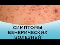 Симптомы венерических болезней