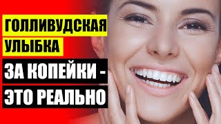 😬 ЗВЕЗДЫ ДО И ПОСЛЕ ВИНИРОВ 🎯 ВИНИРЫ НА ВСЮ ЖИЗНЬ