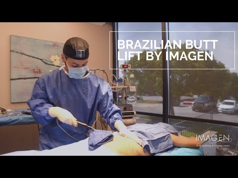 Brazilian Butt Lift | Omaha Liposuction by Imagen