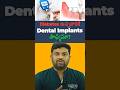 డయాబెటిస్ ఉన్నవారికి డెంటల్ ఇంప్లాంట్స్ చేయించుకోవచ్చా? Safe or Risky? || Eledent Dental Hospitals