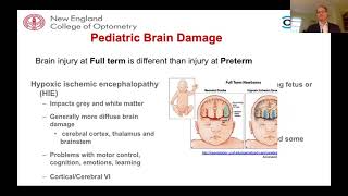 An Overview of Cerebral Vision Impairment screenshot 1