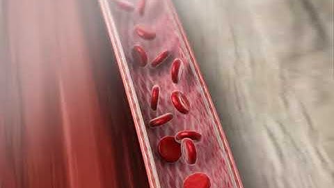 peripheral vascular disease