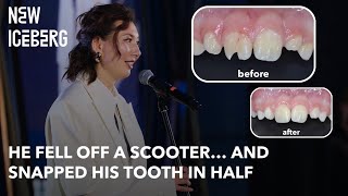 Child Tooth Fracture After Scooter Fall 😳 | Crown-Root Fracture Case (Full 3-Month Treatment)