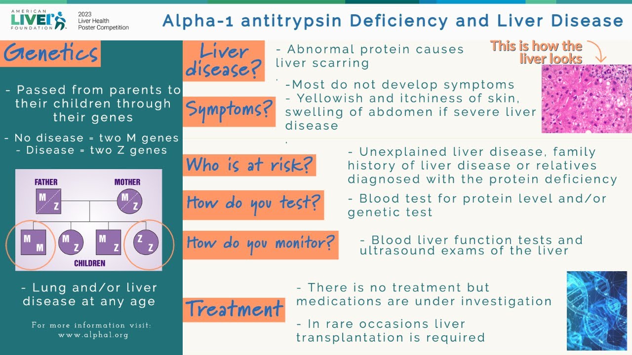 A1A Deficiency and Liver Disease, Juan Gonzalez, MD