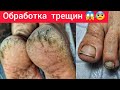 ПЕРВЫЙ РАЗ В ЖИЗНИ 🤯ГЛУБОКИЕ ТРЕЩИНЫ 😱СЛОЖНЫЙ ПЕДИКЮР 😰