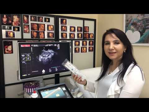Doç.Dr. Meryem Gencer Kadın Doğum Uzmanı Jinekolog - Spiral Taktırma Doğum Kontrol Yöntemi