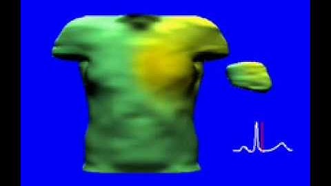 Body surface potential during heart beat