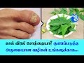 Natural home remedies to treat nail fungus