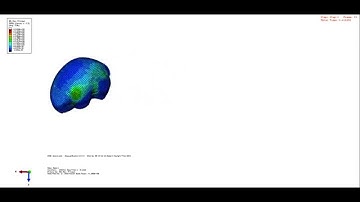 Pediatric Finite Element Brain Model Frontal Car Crash