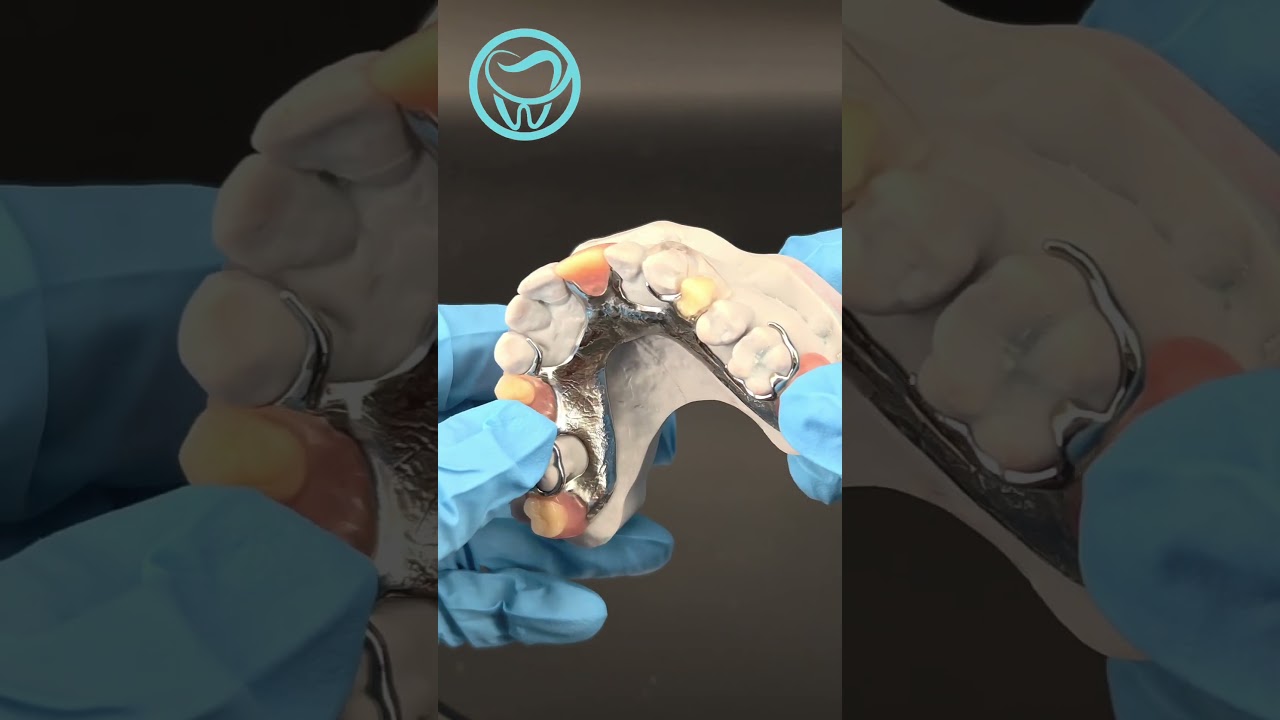 Transparent clasps instead of metal clasp! #dentallab #dentist