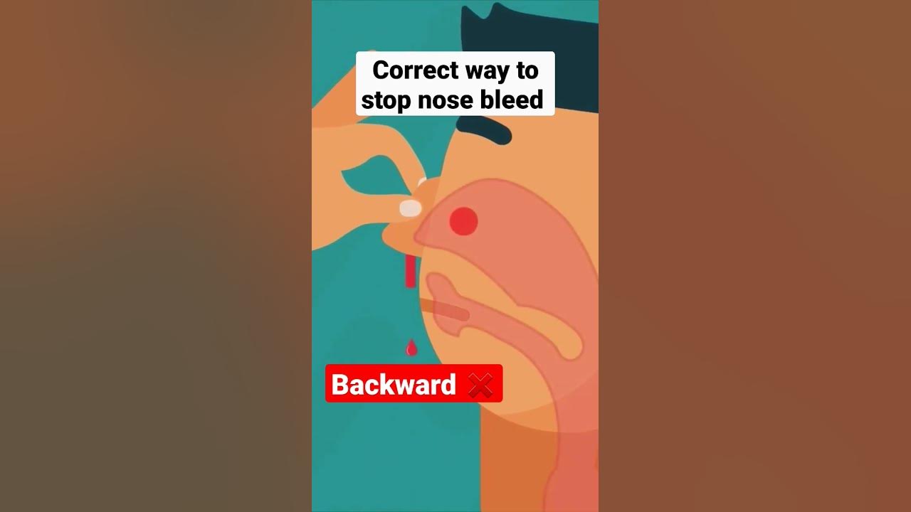nosebleeds-lean-forward-vs-lean-backwards-youtube