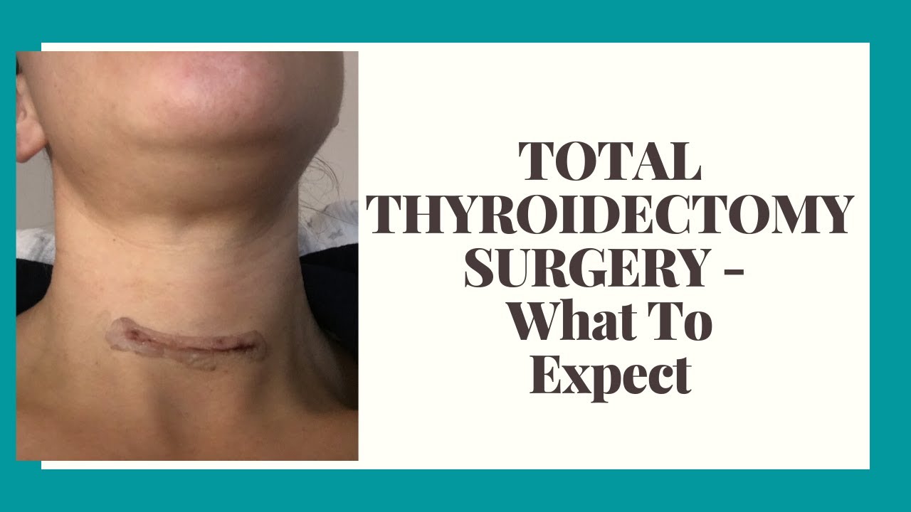 Total Thyroidectomy Surgery Thyroid Cancer Symptoms In Women