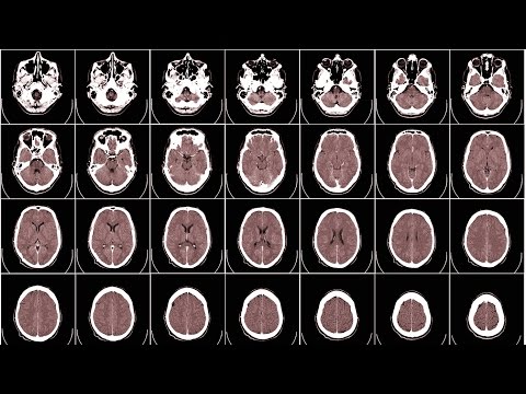 Mapping the Dynamic Brain