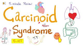 Carcinoid Syndrome | SerotoninSecreting Tumors | 5Minute Review