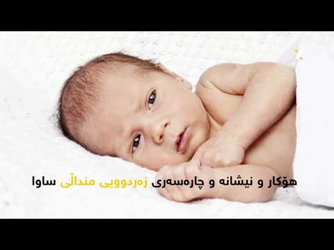 هۆکار و نیشانە و چارەسەری زەردوویی منداڵی ساوا