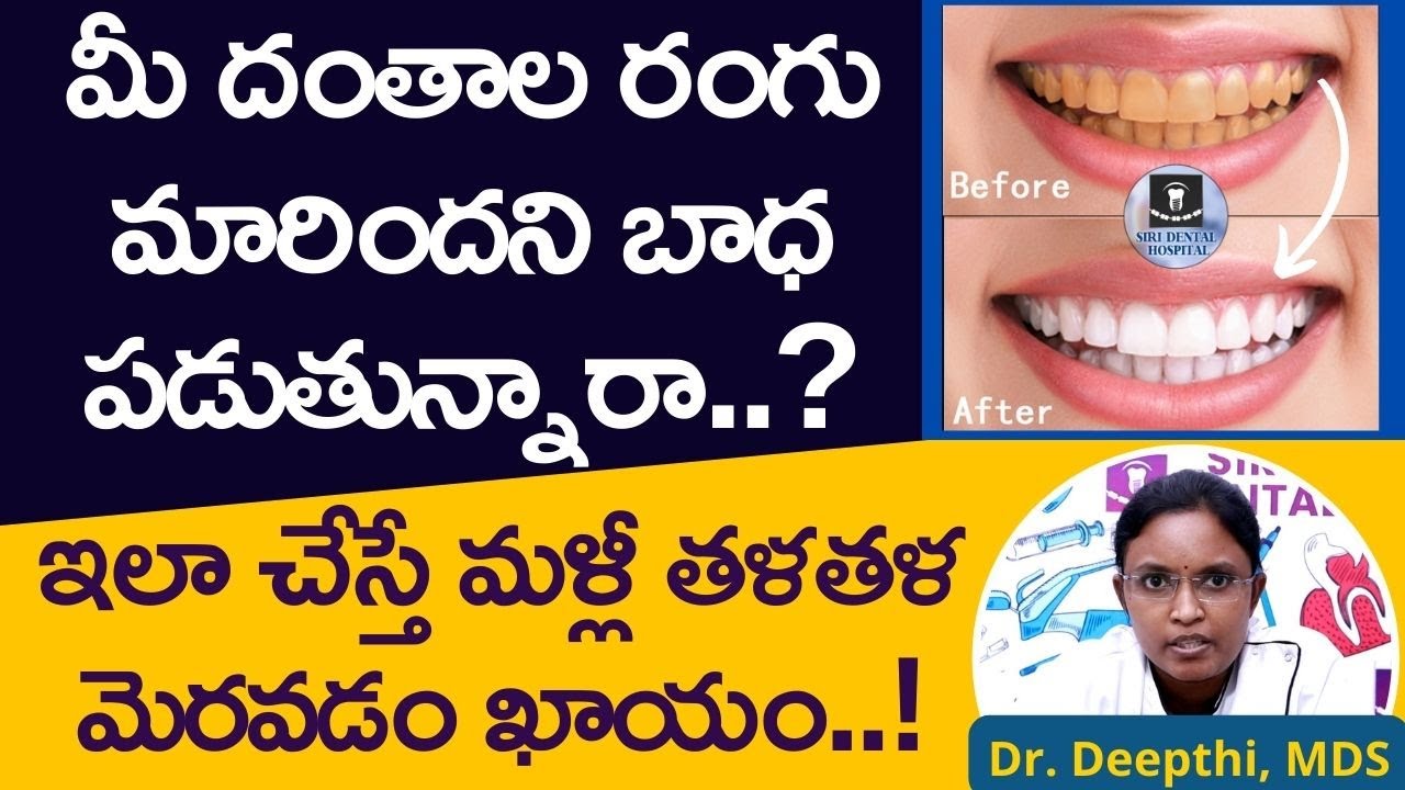 రంగు మారిన దంతాలకు సరైన చికిత్స | Tooth Discoloration: Causes and Treatment | Siri Dental Hospital
