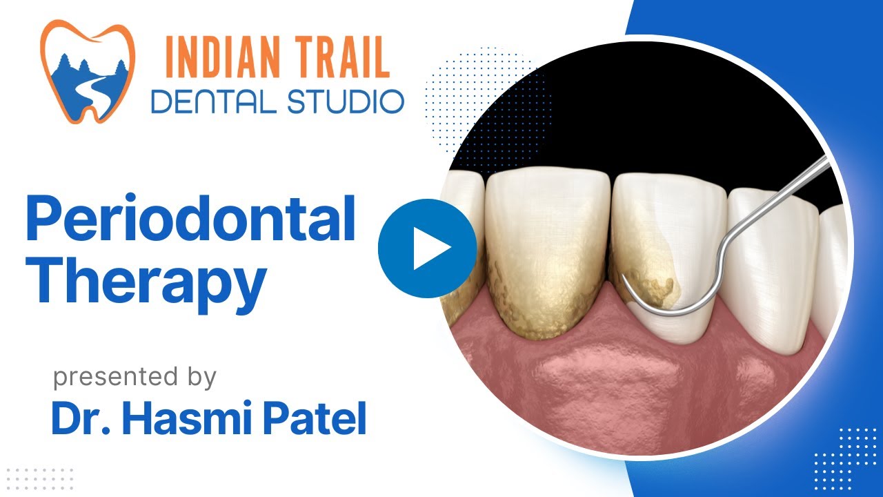 Periodontal Cleaning - Deep Dental Cleaning - Indian Trail NC