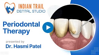 Periodontal Cleaning - Deep Dental Cleaning - Indian Trail NC