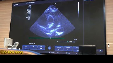 Hướng dẫn thực hành siêu âm tim | Bs. Phạm Thu Thủy | 2020