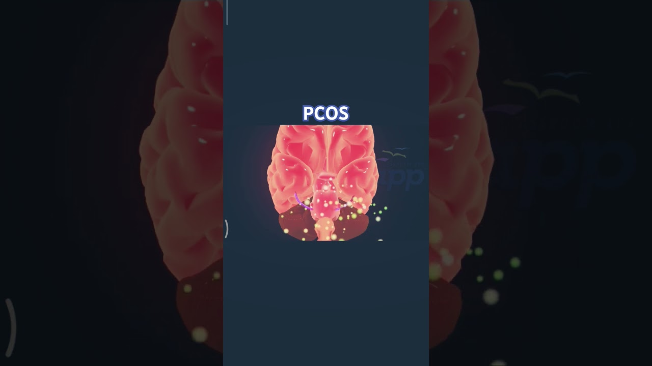 3D clear understanding of PCOS syndrome/Clear view prevention n cure