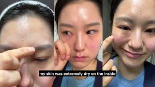 How I repair my skin barrier in 4 days (at home, with affordable skincare routine)