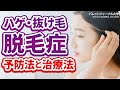 【話題の薄毛】脱毛症・ハゲに迫る！今すぐに使える対策がある？