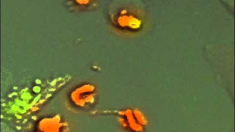 Killer T cells and cancer - Nature Medicine - Video.wmv