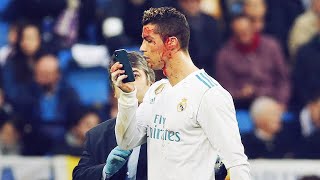 Les 4 Pires Blessures De La Carrière De Cristiano Ronaldo Oh My Goal
