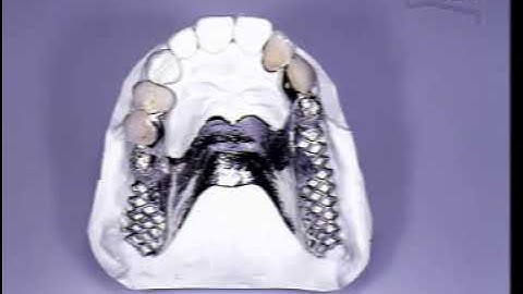 CEKA Attachment part 4