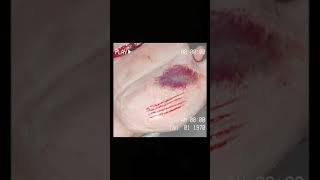 Forensic project