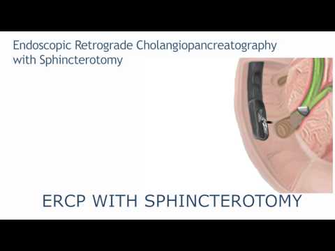 ERCP with sphincterotomy