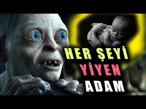 BEBEK Dahi Ne Bulursa Yiyen İnsanın Hayat Hikayesi  👀 Her Şeyi YİYEN ADAM TARRARE'nin Hikayesi 😱