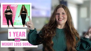 1 Year After Weight Loss Surgery And  Weight Loss Results. Worth It Or Regret The Duodenal  Switch?