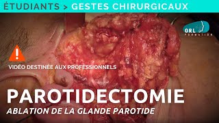 Parotidectomy Surgical Procedure