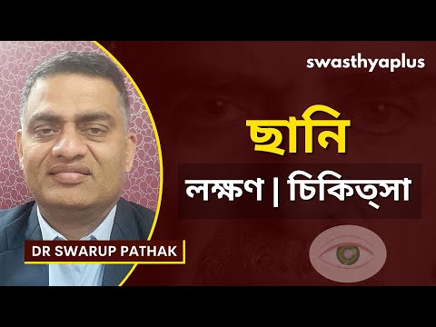 কিভাবে ছানি প্রতিরোধ করা যায়? | Cataract: How to Treat it? in Bangla | Dr Swarup Pathak