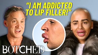 Famous REJECTED by Botched: Jordan’s Lips Won’t Stop LEAKING After Too Much Filler | Botched | E! Net Worth