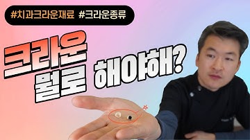 치아 보철 치과 크라운 어떤 걸로 씌워야 해요? 치과 크라운 종류 골드크라운 PFM크라운 지르코니아크라운ㅣ수원 김기록치과