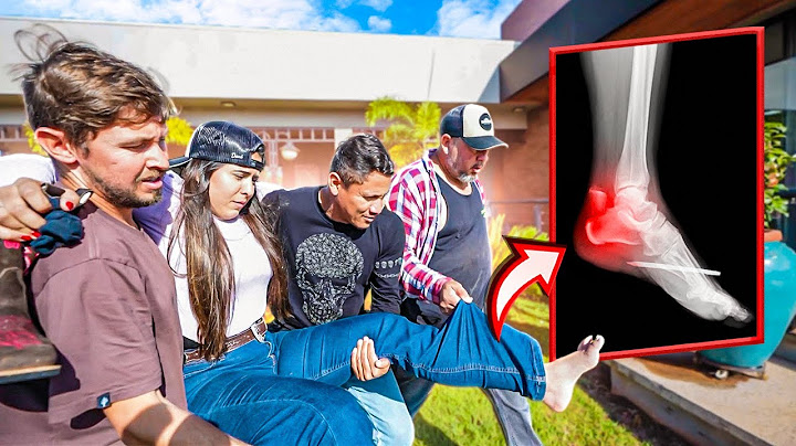 SOFRI UM GRAVE ACIDENTE NA FAZENDA!! FUI PRO HOSPITAL