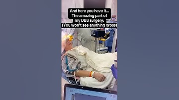 My DBS part 2: Leads have been placed and I am able to conduct again . Tremors are controlled