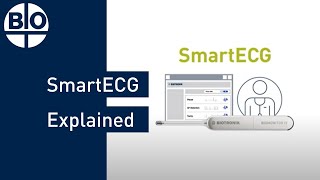 SmartECG Explained: How SmartECG Can Help Improve Arrhythmia Detection