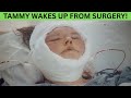 TAMMY WAKES UP FROM HER MAJOR SKIN REMOVAL SURGERY! 1000 Lb. Sisters